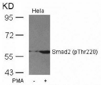 Western Blot: Smad2 [p Thr220] Antibody [NBP1-04982]